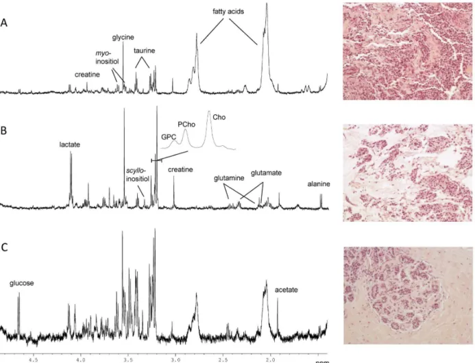 Figure 1. HR MAS spectra and illustration of typical features observed in the corresponding HES images (200X)