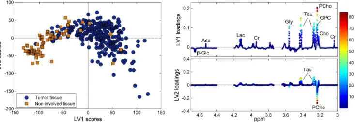 Figure 4. Variation in tumor cell content as described by PCA of the choline region. (A) The score plot of the choline-containing metabolite region of the spectra, colored according to the tumor cell content (%) of the corresponding biopsies