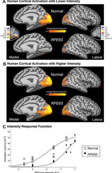 Figure 6C plots the volume of cortical tissue that demon- demon-strated a robust response to visual stimulation in control individuals and RPE65-LCA patients
