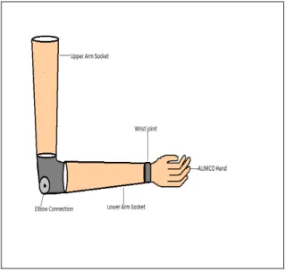 Figure 1 – Shell of the prosthesis 