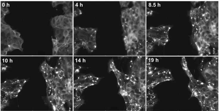 Figure 4. Cucurbitacin I inhibits motility of B16-F1 melanoma cells. Phase-contrast images of migrating B16-F1 cells were captured every 30 s on a laminin-coated dish