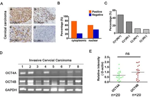 Fig 1. Identification of OCT4 isoforms in human cervical cancer. (A), OCT4 expression status in 50 cervical cancer patients was divided into four groups based on staining patterns and subcellular localization: