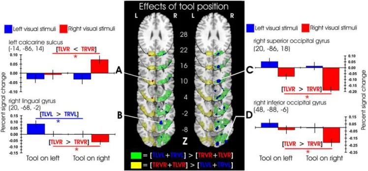 Figure 2. Effects of visual distractor position and tool tip position. The central panel shows the significant clusters of activation for the simple effects of visual distractor position, and the effects of tool tip position within those visual contrasts, 