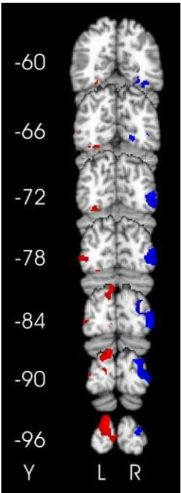 Figure 5. Main effects of visual distractor position within clusters defined by the multisensory contrasts