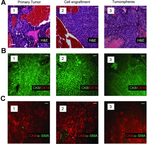 Figure 2. Tumors arising from transplant of single tumor cells recapitulate the histology and cellular composition characteristic of the parental tumors