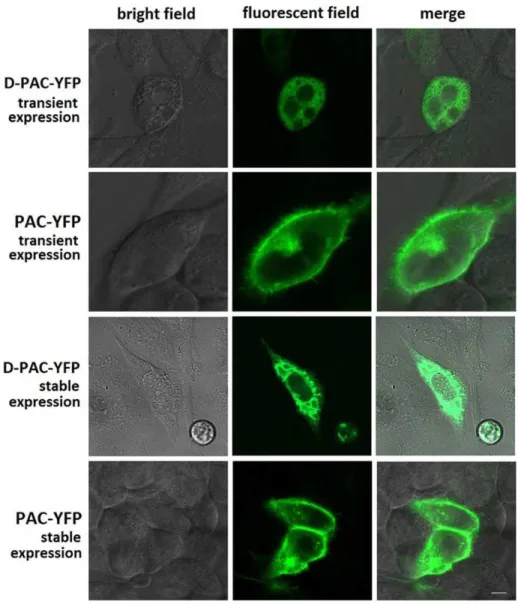 Figure 2. Morphologic localization of YFP-tagged PAC1 and YFP-tagged D-PAC1. Shown were confocal fluorescence micrographs of CHO cells expressing YFP-tagged PAC1 and YFP-tagged D-PAC1 transiently and stably in light field, fluorescent field and their merge