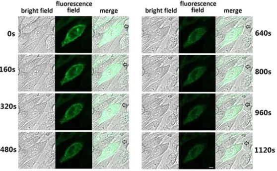 Figure 7. Morphologic localization of YFP-tagged M-PAC1. Shown were confocal fluorescence micrographs of CHO cells expressing YFP- YFP-tagged M-PAC1 transiently and stably in light field, fluorescent field and their merge