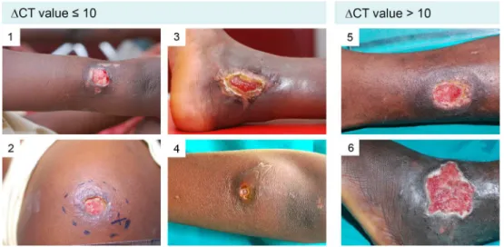Fig 3. Examples of lesions presenting with both IS2404 qPCR positive and negative swabs
