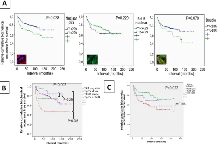 Fig 3. Association between nuclear p65 and/or RelB and biochemical recurrence in prostate cancerpatients