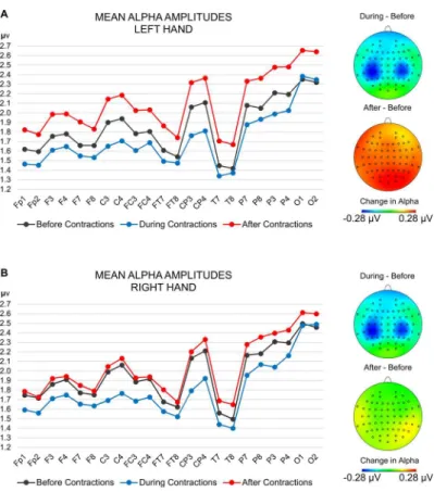 Fig 1. Plot of the alpha amplitudes at each electrode before, during and after contractions