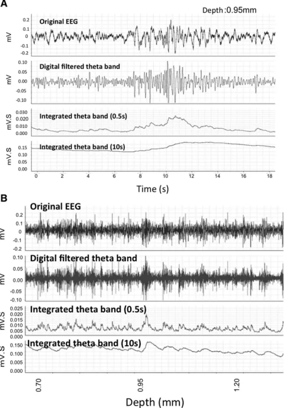 Figure 2.  Representative EEG data.  A. Raw EEG data collected from a recording electrode (top) and filtered EEG after selecting for theta oscillations (4-8 Hz) (middle)