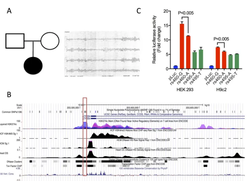 Fig 2. STMP identifies a likely functional regulatory variant in a novel candidate disease gene for neonatal ventricular arrhythmia