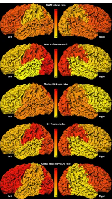 Fig 5. Regional evaluation (in terms of standard boxplots) for, from top to bottom: UWM volume, inner cortical surface area, median cortical thickness, gyrification index, and global mean curvature