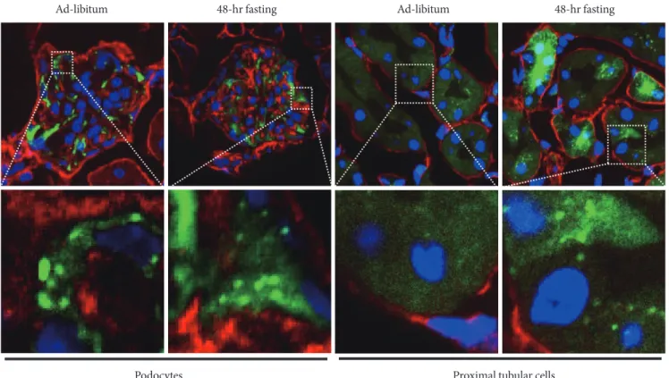 Fig. 2. Autophagy activity determined using green fluorescent protein light chain 3 (GFP-LC3) transgenic mouse