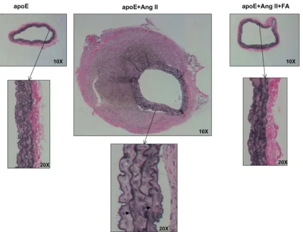 Figure 4. Folic acid reduces matrix degradation in Ang II-infused apoE null mice. Abdominal aortas were collected from sham operated (left column), Ang II-infused (center column), and Ang II-infused and folic acid (FA, right column) treated apoE null mice 