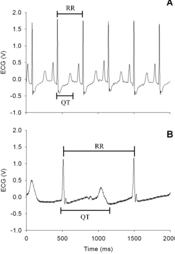 Figure 2. Guinea pig electrocardiograms before (A) and after (B) the administration of sparfloxacin.