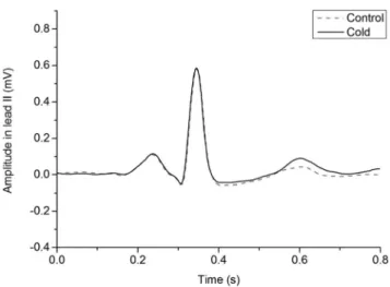 Figure 3. Example ECG presenting changes in cardiac repolar- repolar-ization. Figure presents a median ECG from 10 consecutive beats as an example of changes in T-wave in lead II before (baseline), during, and after (recovery) cold exposure