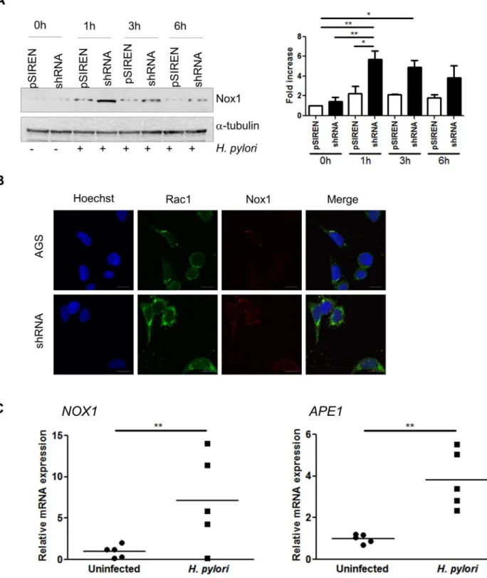 Fig 5. APE1 regulates Nox1 expression. (A) Nox1 expression was examined in AGS pSIREN and shRNA cells infected with H