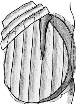 Fig 1: Photograph showing preparation of the  cartilage.