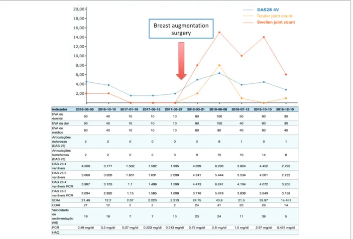 FIGURe 1. Evolution of disease parameters before and after breast augmentation surgery.