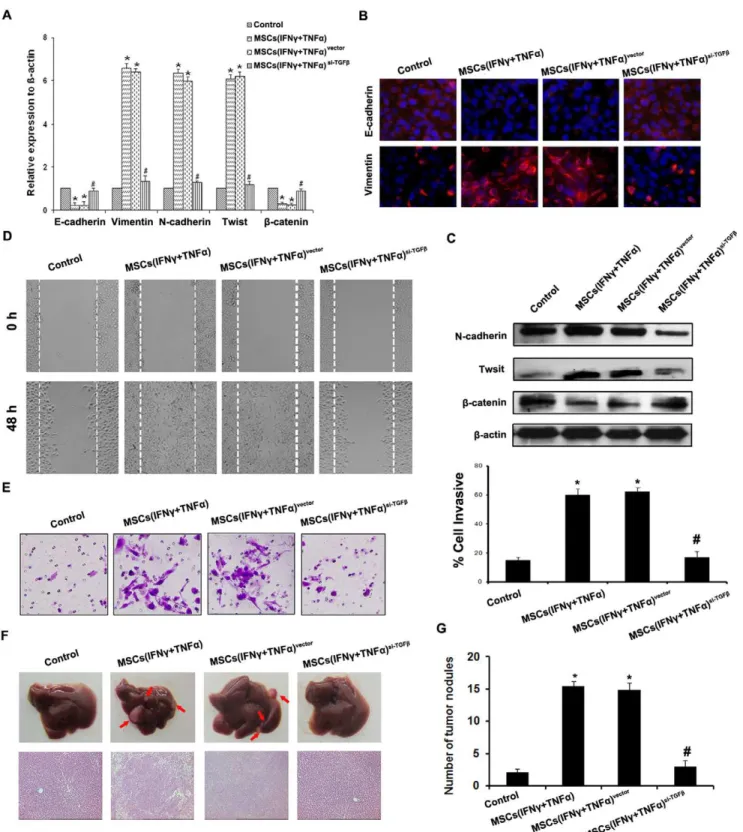 Figure 3. TGF-b depletion in MSCs reverses the promotive effect on metastasis and EMT of HCC cells induced by MSCs in inflammation microenvironment