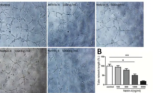 Fig 3. Effect of netrin-4 on HUVECs tube formation. Tube formation was assessed in tubulogenesis assay in vitro model, HUVECs were serum-starved with EBM2 medium (0.1% FBS, no growth factor) (Lonza) for 12 hours