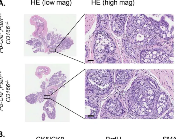 Figure 7. Loss of CD166 does not block castration resistant prostate tumor progression in Pb-Cre + ;Pten L/L ;CD166 2/2 mice