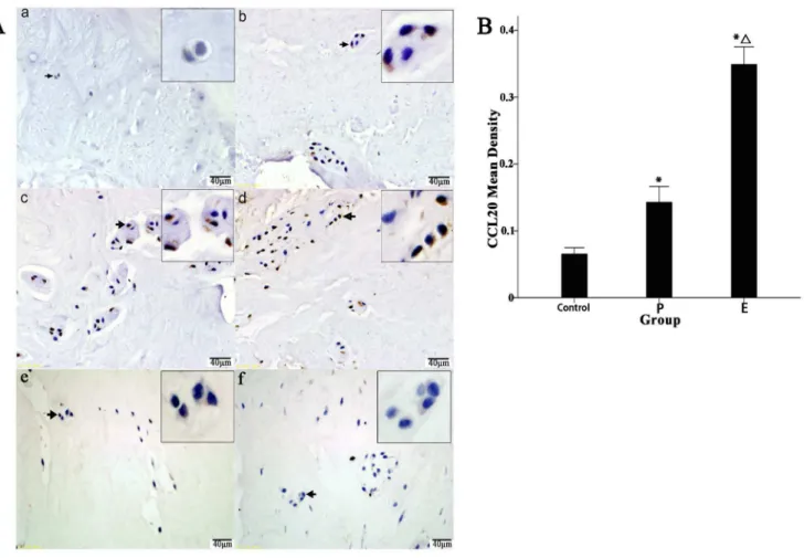 Figure 1. Immunohistochemical localization of CCL20 in human IVD tissues and comparison of mean density scores of the positive cells between the three groups