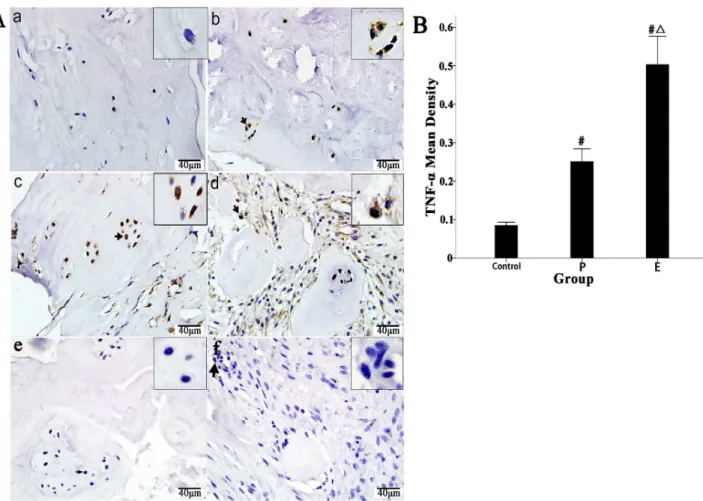 Figure 2. Immunohistochemical localization of TNF- a in human IVD tissues and comparison of mean density scores of the positive cells between the three groups
