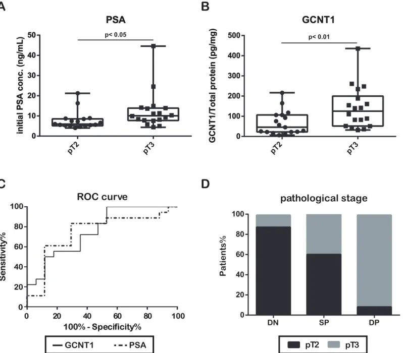 Fig 3. Prostate-specific antigen concentration and core2 β-1,6- N -acetylglucosaminyltransferase-1 expression predict extracapsular extension of prostate cancer