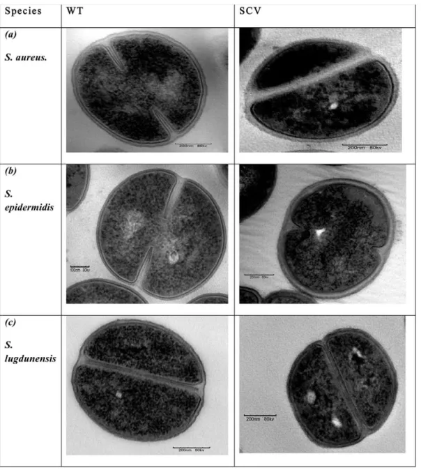 Figure 3. TEM images of (a) S. aureus , (b) S. epidermidis and (c) S. lugdunensis WT and SCV cells showing their respective ultra- ultra-structural characteristics