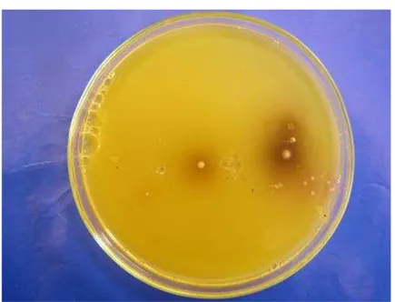 Figure 3. Bacillus cereus colonies grown on the selective medium. 
