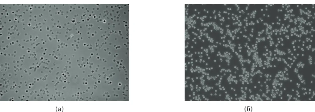 Figure 9. Phase contrast micrographes (magnification ×400) of a) the erythrocyte suspension prior to hemolysis and b) erythrocyte  ghosts produced by gradual hemolysis in the erythrocytes membrane bioreactor