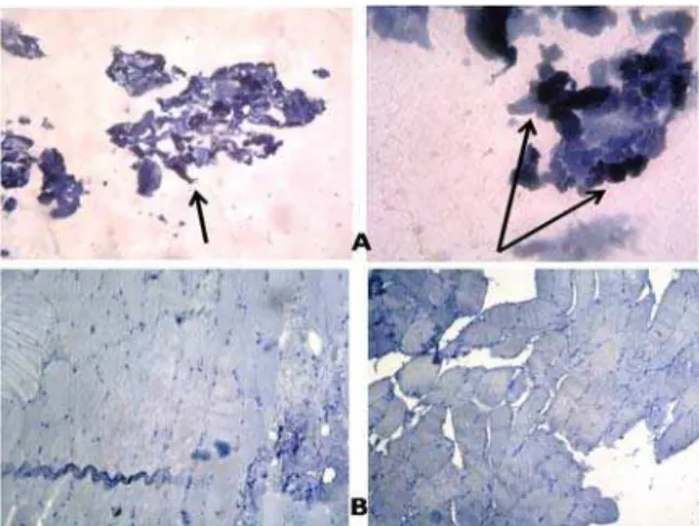 Figure  4.   )mmune‐histochemical  staining  with  p   A   positive  reaction  B  negative reaction  x