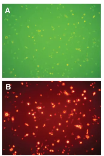 Abbildung 2: Endotheliale Progenitorzellen aus peripherem Blut doppelt positiv für Ulex Europeus Lectin (A) und acetyliertes Di-LDL (B)