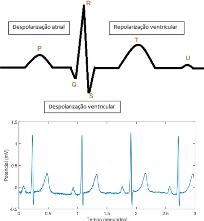 Figura 2.5. Representa¸ c˜ ao gr´ afica de um sinal de eletrocardiografia. O gr´ afico superior consiste em um modelo de um sinal de ECG indicando as fases de  despo-lariza¸c˜ ao e repolariza¸c˜ ao e o gr´ afico inferior consiste em um sinal de ECG real – 