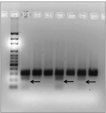FIGUrE 1. Agarose gel showing positive samples for IL-17 rs2275913 (arrows)