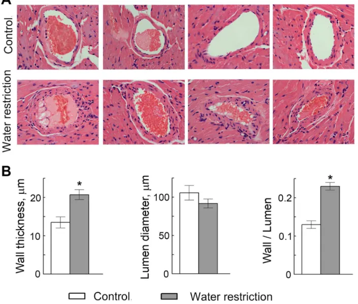 Fig 5. Water restriction causes thickening of the walls of coronary arteries in ApoE -/- mice