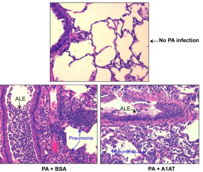 Fig 4. Representative lung tissue histopathology pictures (H&amp;E staining; magnification, x200) from ENaC transgenic mice