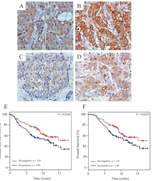 Fig 6. Immunohistochemical staining of Src expression and phosphorylation in primary breast tumors and Kaplan-Meier survival estimates relative to the expression of Src at the plasma membrane