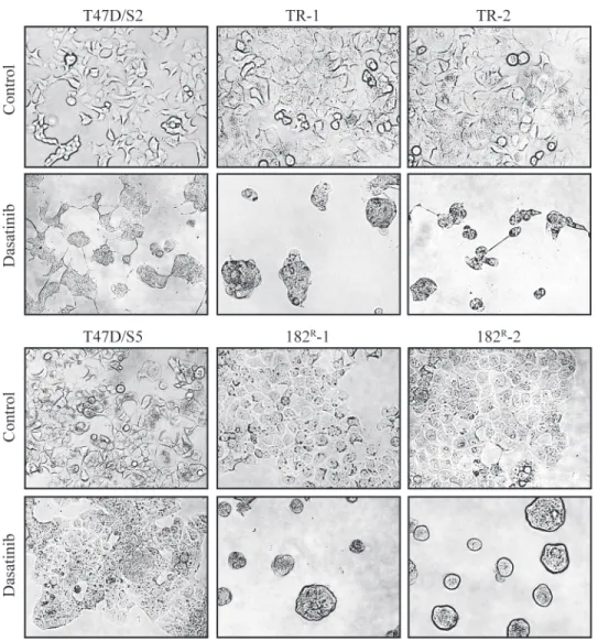 Fig 2. Effect of dasatinib on the morphology of parental and resistant cells. Representative pictures of parental (T47D/S2 and T47D/S5), tamoxifen (TR-1 and TR-1) and fulvestrant (182 R -1 and 182 R -2) resistant cell lines treated for five days with dasat