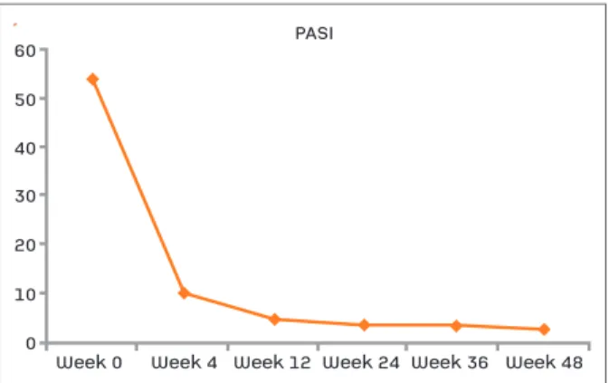 FIGURE 1. The Psoriasis Area Severity Index (PASI) evolution during the first year of UST treatment