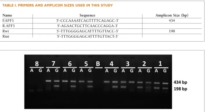 fIgure 1. ARMS-PCR gel electrophoresis for AFF1 A/G polymorphism in 7 samples. Samples 1 and 2 are heterozygote (AG), sample 3 is homozygote for A allele (AA) and samples 4-7 are homozygote for G allele (GG)