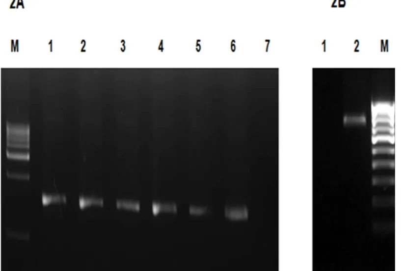 Fig 2. (A) Gel electrophoresis of PCR amplified 16S rDNA for the DNA extracted using the powdered glass method M6