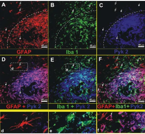 Fig 3 demonstrates the relative levels of phosphorylated Pyk2 in control glioma cells, glioma cells treated with medium conditioned from microglia (MCM) or medium conditioned from microglia that was first co-cultured with glioma (AMCM) to simulate the cros