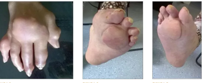 FIGURA 1. FIGURA 2. FIGURA 3.