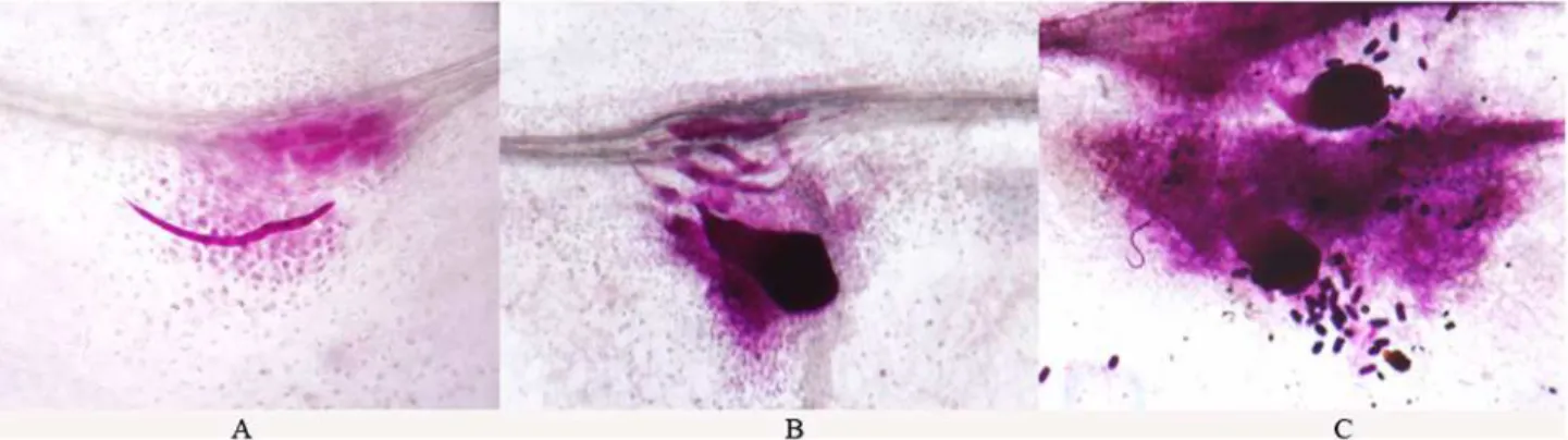 Fig 1. M. incognita on alfalfa excised root culture, four weeks post inoculation. A: infective juveniles