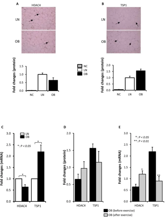 Figure  4.    HDAC4  and  TSP1  are  also  differentially  expressed  in  the  adipose  tissue  of  obese  humans