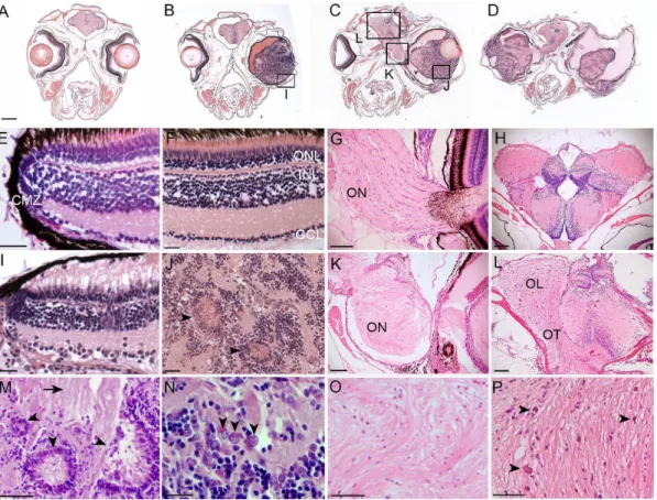 Figure 3. Histological analysis of Tg(flk1:RFP)is18 tumors reveals similarities with retinoblastoma and glioma
