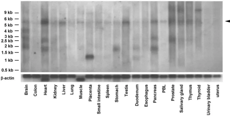 Figure 5. Analysis of MAMDC1 mRNA expression. Northern blot analysis of MAMDC1 mRNA expression in different human tissues, showing several expressed splice variants